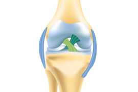 Stay Strong and Stable With Knee Ligament Surgery, Melbourne