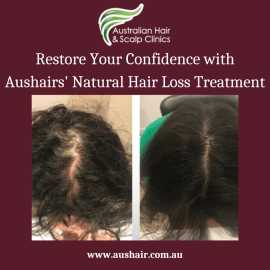 Restore Your Confidence with Aushairs' Natural Hai, Murrumbeena