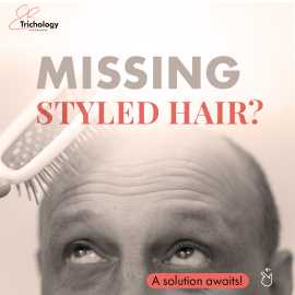 Male Pattern Hair Loss In Gurgaon, Gurgaon