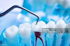 Best dentists for tooth extraction in Delhi, Delhi