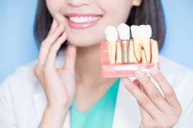 Role of Cosmetic Dentistry in Achieving Natural, Bengaluru
