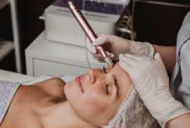 RF Microneedling: A Non-Surgical Approach to Skin , Yishun New Town