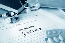Lymphoma Testing: Your Path to Clarity | Lymphoma , Mississauga