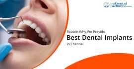 Understanding Dental Implants: Types and Uses | De, Ahmedabad