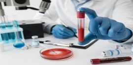 Book CBR & CRP Blood Tests at Max Lab, Gurgaon