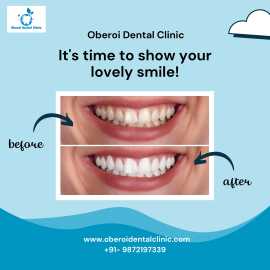 Show Your Lovely Smile - Oberoi Dental Clinic, Jalandhar
