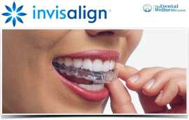 Top Invisalign Orthodontists in Ahmedabad | Book Y, Ahmedabad
