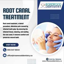 Root Canal Service in, Hamilton