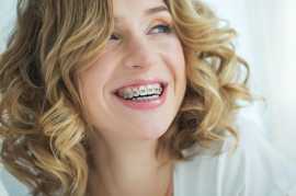 Transform Your Smile Guide To Dental Braces, Thane