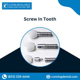 Screw In Teeth |Denture Implants | Overdentures CA, Montclair