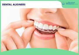 Transform Your Smile with Clear Aligners | dental , Ahmedabad