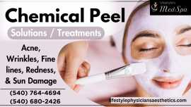 How Does a Chemical Peel Work? , Warrenton