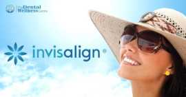 Transform Your Smile: Affordable Invisalign Offers, Ahmedabad
