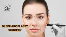 Blepharoplasty Surgery in Hyderabad, Hyderabad