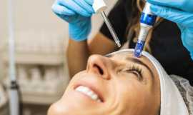 Rejuvenate Your Skin with Microneedling Services i, San Diego