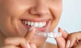 MAINTAINING ORAL HEALTH DURING INVISALIGNTREATMENT, Thane