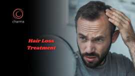 Best Hair Loss Treatment In Bangalore, Bengaluru