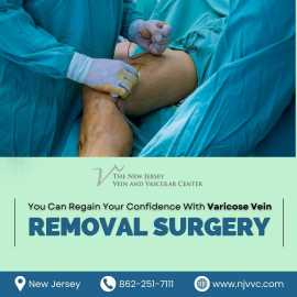 Varicose Vein Removal Surgery in NJ, Randolph Township
