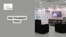Best Hair Transplant Clinic In Gurgaon, Gurgaon