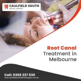 Get a root canal treatment in Melbourne, Caulfield South