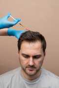 Get Your Hair Back with FUE Hair Restoration, Richmond